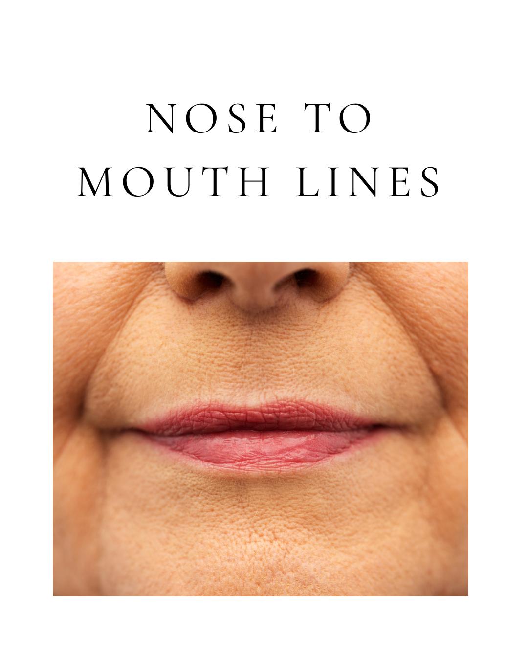 Nose to Mouth Lines